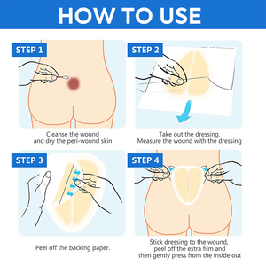 Kích thước lớn siêu dày Hydrocolloid vết thương mặc quần áo tấm Hydrocolloid các bản vá lỗi - Product Image 6