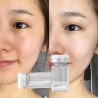 프라이빗 라벨 무균 히알루론산 MTS 스킨케어 앰플 세럼 히알루론산 보습 페이스 메조 테라피 세럼 대량