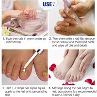 Vente en gros de sérum pour les ongles IBeaLee Glass 7 jours, réparation naturelle, prévention, anti-fongique, soin des ongles, traitement des mycoses des ongles
