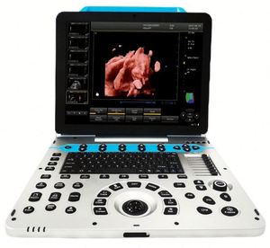<span class=keywords><strong>Precio</strong></span> de Fábrica, Máquina de Ultrasonido Doppler a Color Portátil 2D 3D 4D <span class=keywords><strong>5D</strong></span>, Totalmente Digital, para Diagnóstico - Product Image 2