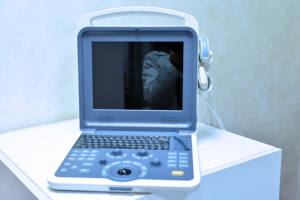 Mesin <span class=keywords><strong>Ultrasound</strong></span> Doppler warna portabel, sistem diagnostik <span class=keywords><strong>Ultrasound</strong></span> warna Digital Doppler untuk manusia - Product Image 5