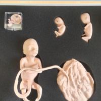 Modelo de Desarrollo Embrionario Uterino Femenino Yulin, Aplicable a Obstetricia y Ginecología Durante el Desarrollo del Embarazo, CE/ISO