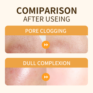 Espuma Limpiadora Facial con Vitamina C de Marca Privada OEM, Suave y Aclarante, Control de Grasa y Minimiza Poros - Product Image 2