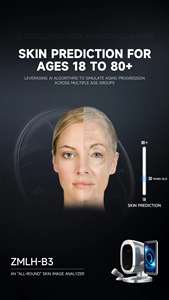 Cámara de Análisis de Piel Bitmoji B3, IA Profesional para el Rostro, Diagnóstico Facial Inteligente, Máquina de Análisis de Piel - Product Image 4