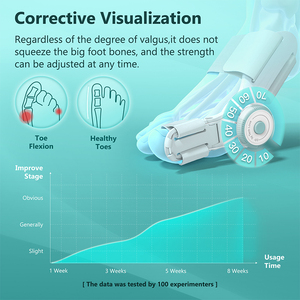 Productos populares al por mayor de fábrica 2023 trending anti quintos mains et pieds separadores de <span class=keywords><strong>Barillas</strong></span> - Product Image 3