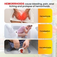 Crème pour hémorroïdes à base de plantes naturelles Sumifun en gros OEM, pommade pour fissures anales longue durée pour les soins de santé K10167