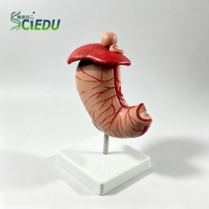 Modelo de Estómago Patológico SCIEDU para la Enseñanza de la Anatomía del Sistema Digestivo Humano - Product Image 1