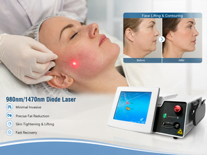 <span class=keywords><strong>Prix</strong></span> d'usine, laser diode 980/1470 nm, endolaser chirurgical intelligent, lipolyse, endolifting pour le visage et le corps, machine de beauté multifonctionnelle - Product Image 1