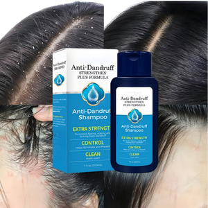 Shampoo antipelliculaire <span class=keywords><strong>extra</strong></span> fort, soin du cuir chevelu, aide à contrôler les pellicules et l'inconfort du cuir chevelu, lavage quotidien des cheveux - Product Image 1