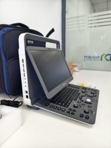 Système d'échographie Doppler couleur portable de diagnostic Sonoscape E1EXPV de qualité supérieure pour les hôpitaux et les cliniques - Product Image 5