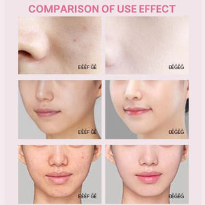 Kore biyolojik kollajen levha elastik hidrolize Supramolecular derin yüz nemlendirici kırışıklık kaldırma yüz için kollajen - Product Image 3