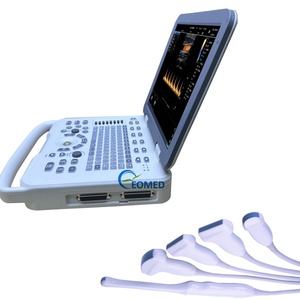 Système Doppler Couleur Fiable avec Sonde Complète pour Petites Pièces et Vérification Vasculaire – Échographe Vétérinaire et Humain CU20-2 - Product Image 1