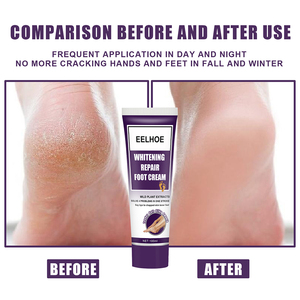 Balsamo per il tallone all'ingrosso ricco idratante ed esfoliante all'ingrosso <span class=keywords><strong>crema</strong></span> per la riparazione dei <span class=keywords><strong>piedi</strong></span> secchi Heal Foot Callus <span class=keywords><strong>crema</strong></span> Gel per la rimozione della pelle morta - Product Image 3