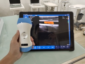 Escáner de Ultrasonido Doppler Color Inalámbrico 3 en 1, Sonda Inalámbrica, Equipo Hospitalario - Product Image 2