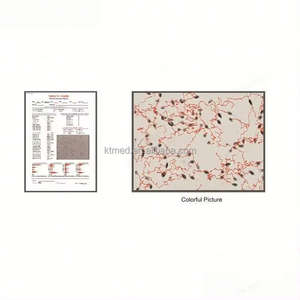 Analizador de Semen KTMED, Máquina Automática de Análisis de Esperma Portátil, Microscopio de Esperma Bovino, Analizador de Semen Canino Veterinario - Product Image 5