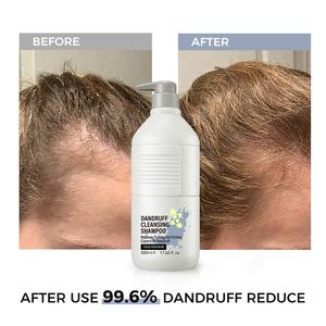 QQuaker Prix Usine Salon Professionnel Shampooing <span class=keywords><strong>Antipelliculaire</strong></span> Oem Shampooing Cheveux de Haute Qualité pour Cheveux Gras - Product Image 5