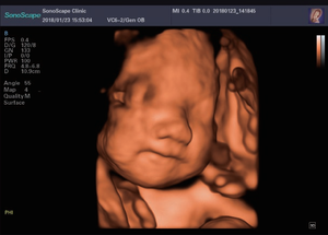 SONOSCAPE P25 Elite Appareil d'échographie 4D Scanner d'échographie médicale pour l'obstétrique, la gynécologie, la pédiatrie, l'urologie - Product Image 5