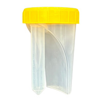 Vaso Recolector de Orina No Estéril de 80 ml Sin Aguja con Tubo Desmontable de 10 ml, Contenedor de Muestras para Análisis de Orina Automatizado