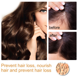 Custom Private Label Anti Loss Natural Organic Rice Water Fast Wild <b>Hair</b> <b>Growth</b> <b>Serum</b> Oil <b>for</b> Men <b>Women</b> - Product Image 4