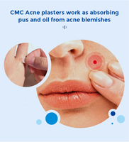 Patchs Hydrocolloïdes Anti-Acné Parfumés Style INS Mignon, Autocollants Bio Personnalisables pour l'Élimination des Imperfections