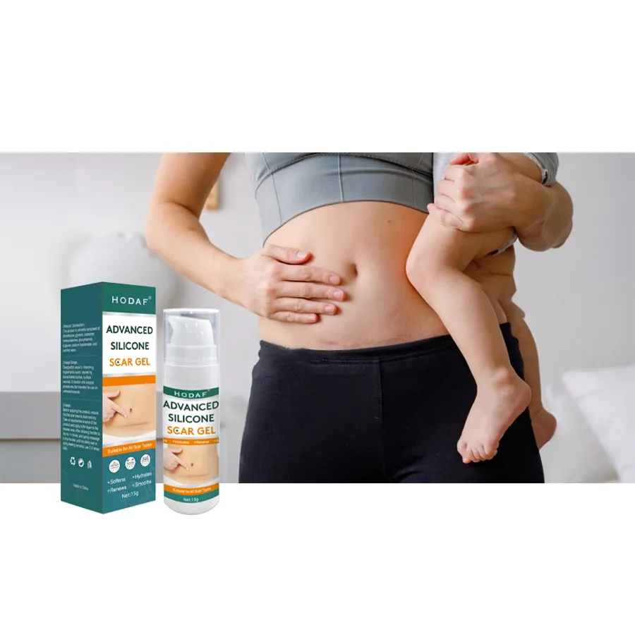 Oem ODM sẹo sửa chữa loại bỏ vết sẹo của phẫu thuật và ghi chống sẹo Kem Stretch Mark loại bỏ Gel