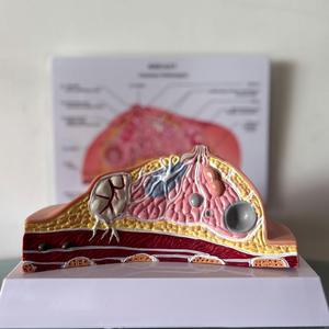 Tıbbi Öğretim İçin Yaygın Patolojileri İçeren İnsan Meme Anatomisi Modeli - Product Image 3