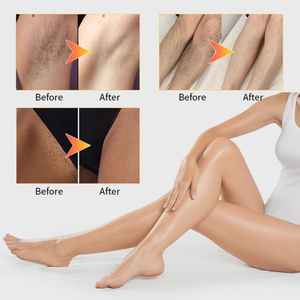 Picosecond Tattoo Permanent Makeup Removal Carbon Peel 3 Wave 808nm Diodelasersing Hair Removal Machine - Product Image 4