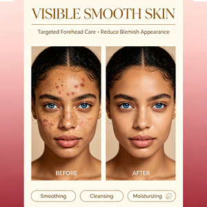 Crème Visage Éclaircissante et Hydratante en Gros pour Uniformiser le Teint, Puissante Contre les Imperfections et les Taches Brunes - Product Image 4