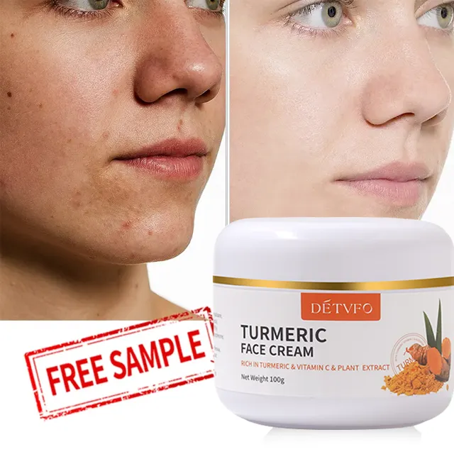 Private label skin lightening cream tumeric removal dark spot removing face cream lotion face whitening cream for black skin