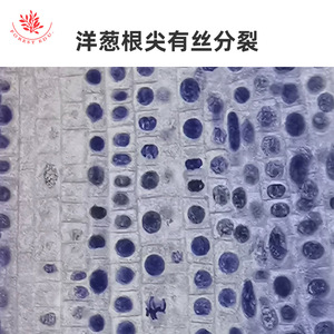 Mitosis de células animales (por ejemplo, huevos de lombrigas equinas); mitosis de puntas de raíz de plantas (objetivo microscópico) - Product Image 2