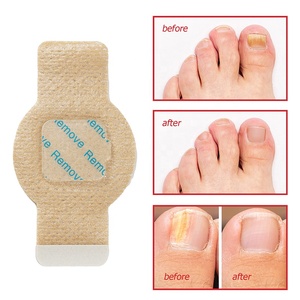 Vente en gros usine : Patchs antifongiques pour ongles, soin des pieds, <span class=keywords><strong>traitement</strong></span> des mycoses, renforcement des ongles - Product Image 1