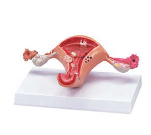 Geavanceerde pvc Vrouwelijke Interne Genitale orgel anatomisch Model - Product Image 3