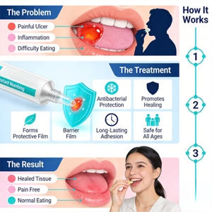 Gel <span class=keywords><strong>para</strong></span> Úlceras Bucales 10g <span class=keywords><strong>para</strong></span> Todas las Edades, Cuidado <span class=keywords><strong>para</strong></span> <span class=keywords><strong>Aftas</strong></span>, Empaque y Logotipo Personalizables, Fórmula Suave <span class=keywords><strong>para</strong></span> Niños y Adultos 2+ - Product Image 3