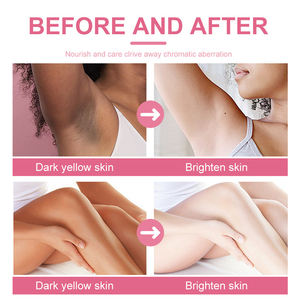 ครีมซูแม็กซ์บำรุงผิวขาวใส วิตามินซี 50 มล. สำหรับจุดซ่อนเร้นและบิกินี่ ลดเลือนจุดด่างดำ สำหรับทุกสภาพผิว (มีสินค้าในสหรัฐอเมริกา) - Product Image 2