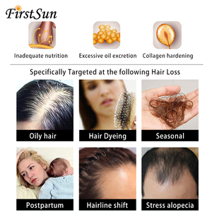 Mejor Precio ingredientes naturales jengibre caída del <span class=keywords><strong>cabello</strong></span> tratamiento <span class=keywords><strong>contra</strong></span> la pérdida del pelo champú para mujer - Product Image 6