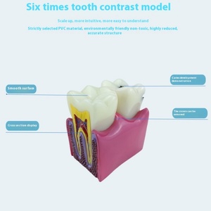 Equipo de Enseñanza Dental Manual FURIEN SMILE, Modelo de Contraste de 6 Pliegues para Detección de Caries, Clase II, Certificado CCC, Uso Comercial y Doméstico - Product Image 4