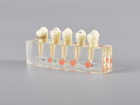 Modelo de estudio Dental, tratamiento endodontico, modelo de educación para pacientes
