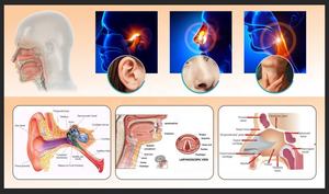 2025 Hete Verkoop Diode Laser 980 + 1470nm Oor Neus En Keel Behandeling Dual Golflengte Machine Otorhinolaryngology - Product Image 4