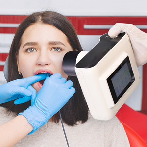 Appareil de radiographie dentaire mini Ray à succès avec système d'imagerie numérique - Product Image 3
