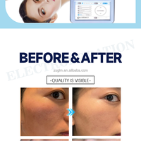 Venta caliente Cuidado de la piel facial Fabricante D Cool Ems Electroporación Mesoterapia Rejuvenecimiento DE LA PIEL Refrigeración Máquina de tratamiento facial