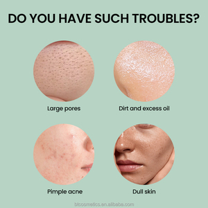 Own Brand Face <strong>Cream</strong> &amp; Lotion for Oily Skin 1-1.5% Benzoyl Peroxide Acne Combination Whitening and Acne <strong>Scar</strong> Repair - Product Image 3