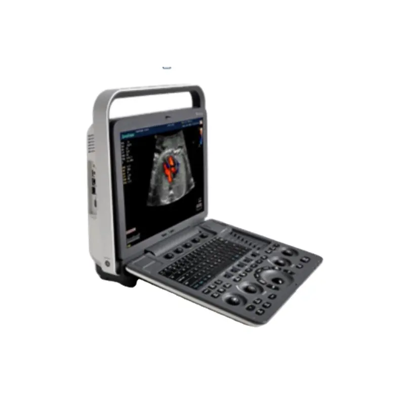 القلب آلة الموجات فوق الصوتية المحمولة سعر الطبية 3D 4D Echocradiography Sonoscape S8