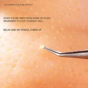 ของเล่นบีบลดความเครียด รูปทรง<span class=keywords><strong>สิว</strong></span> <span class=keywords><strong>หัว</strong></span><span class=keywords><strong>ใหญ่</strong></span> ทำจากซิลิโคน คล้ายสตรอว์เบอร์รี่ บรรเทาความวิตกกังวล - Product Image 6