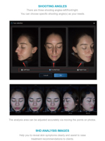 Nouvelle technologie avancée, analyseur professionnel de la peau du visage, Machine à images, ia, pour acné, taches, sensibilité, rides