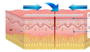 แผ่น<span class=keywords><strong>ปิด</strong></span><span class=keywords><strong>แผล</strong></span><span class=keywords><strong>ผ่าตัด</strong></span>ปลอดเชื้อคุณภาพสูงสำหรับโรงพยาบาล <span class=keywords><strong>เทป</strong></span><span class=keywords><strong>ปิด</strong></span><span class=keywords><strong>แผล</strong></span> Steri-Strip ที่ดีที่สุดสำหรับการ<span class=keywords><strong>ปิด</strong></span>ผิวหนัง - Product Image 3