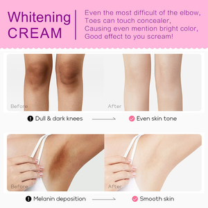 Crema Blanqueadora e Hidratante para Rodillas, Axilas y Zonas Oscuras, Loción Corporal con Ácido Kójico para un Tono de Piel Uniforme - Product Image 5