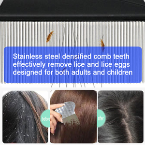 Trung Quốc Nhà Sản Xuất Có Thể Giặt Thép Không Gỉ Không Gỉ Đầu Chấy Lược Lược <span class=keywords><strong>Nit</strong></span> Lược Để Sử Dụng Nhà <span class=keywords><strong>Nit</strong></span> Lược Miễn Phí (Có Logo) - Product Image 4