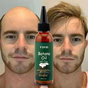 Huile de Batana pour la croissance des cheveux, <span class=keywords><strong>essence</strong></span> pour les soins capillaires, huile essentielle pour l'éclat des cheveux et de la peau, huile de Batana du Honduras 60ml - Product Image 3