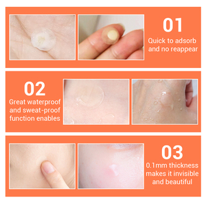 LANBENA Patchs anti-acné et lissants pour la peau, marque privée, pour usage quotidien - Product Image 6