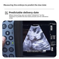 Échographe portable B-mode pour la détection de la gestation animale, sonde rectale compatible cheval, modèle BTS-N41, garantie d'un an